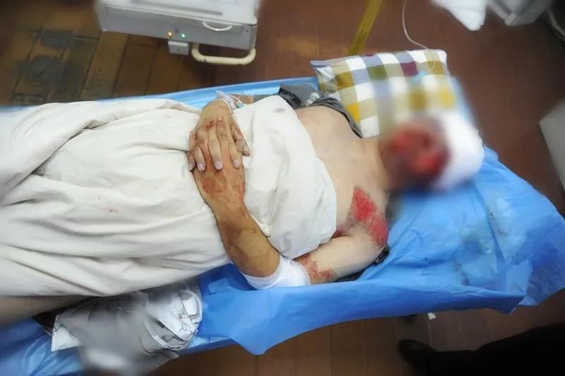 民警在抓捕时遭歹徒开车撞击并碾压拖行数十米,仍在抢救!兄弟,挺住!