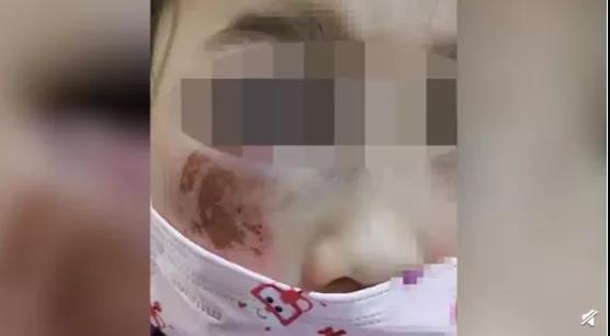 教育之痛!学生做错题,竟遭老师殴打险致失明!【三分钟法治新闻全知道】